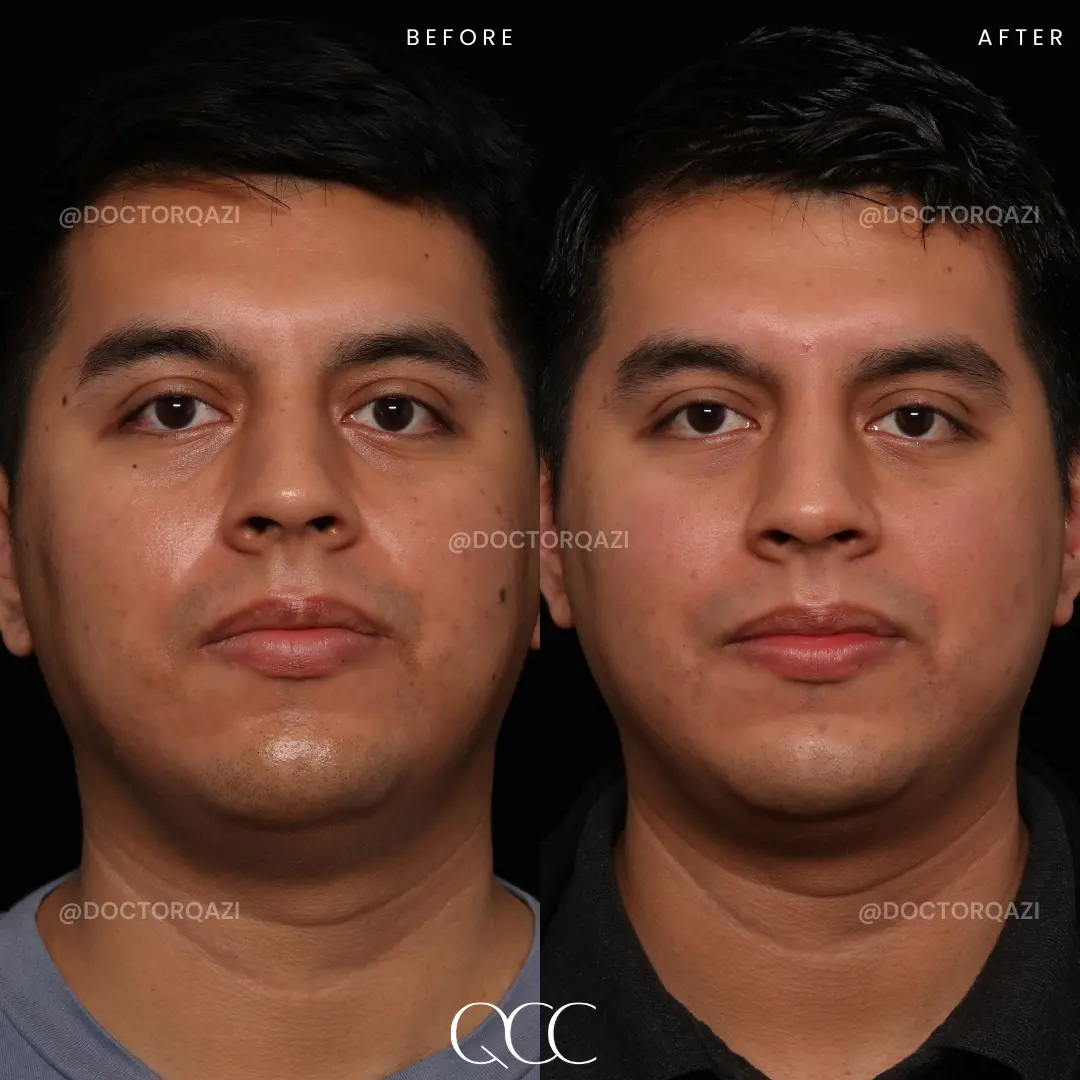 gallery.image.item,51