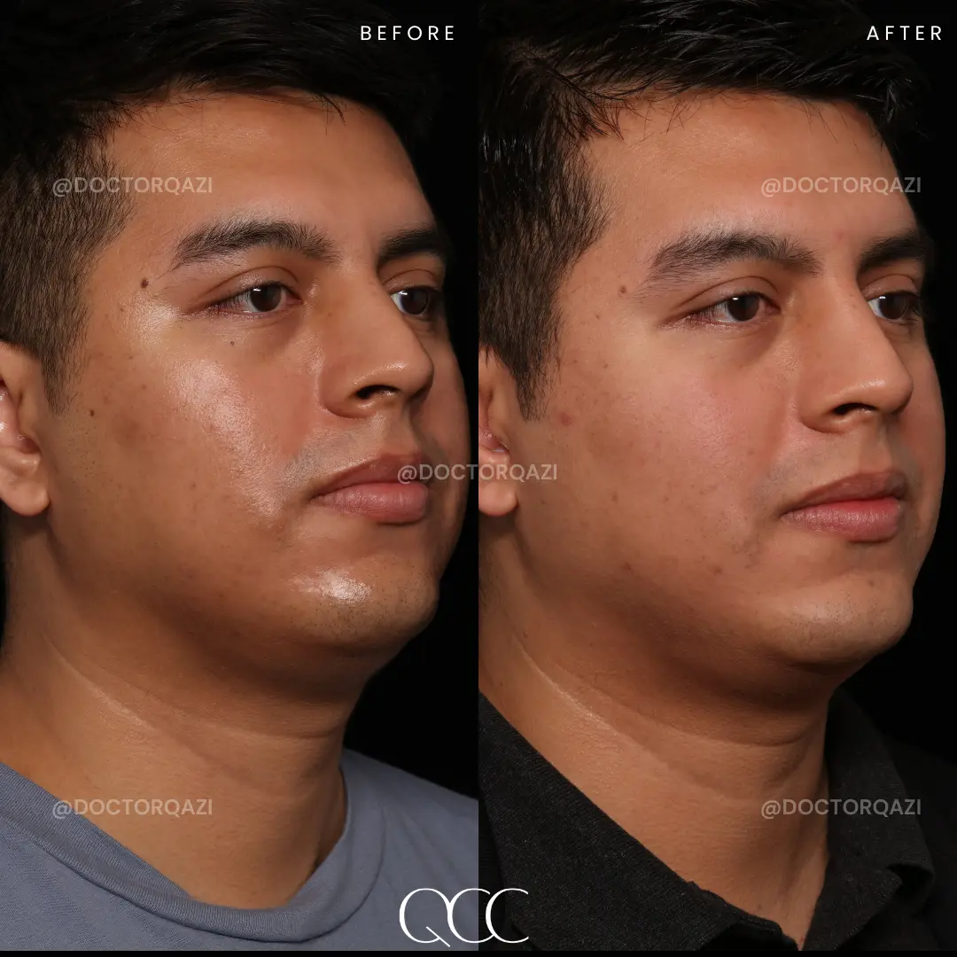 gallery.image.item,52