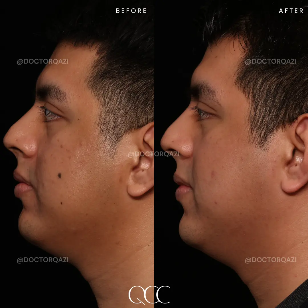 gallery.image.item,54