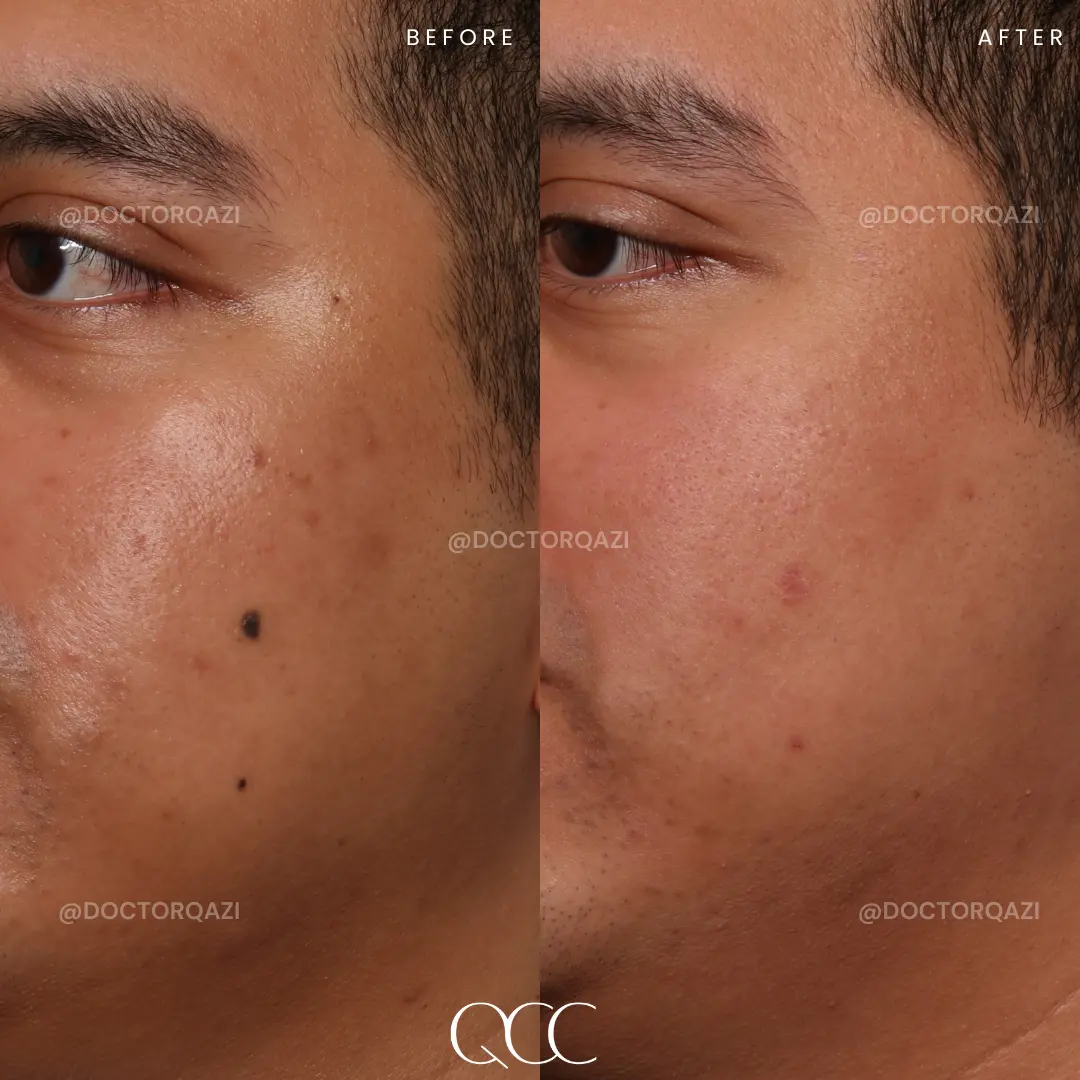 gallery.image.item,55