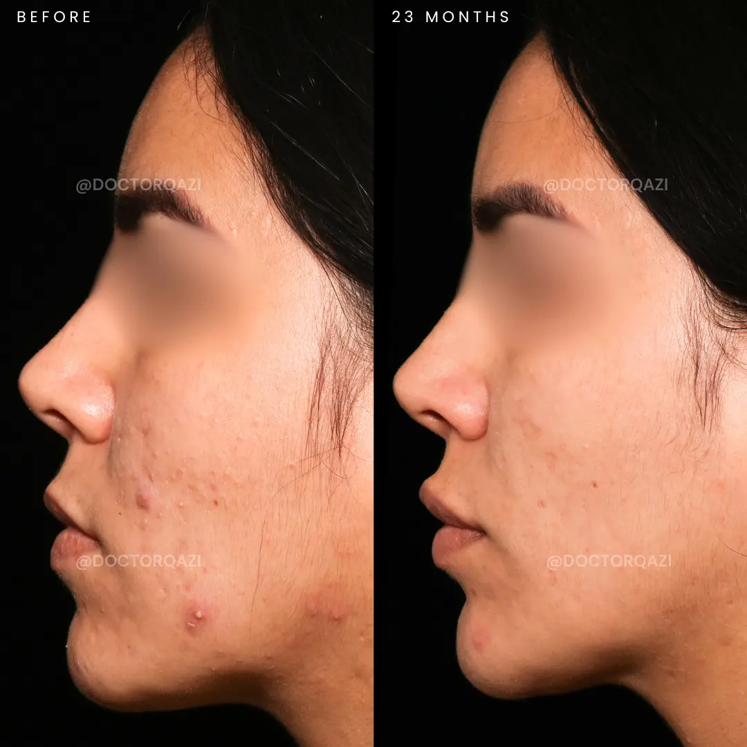 gallery.image.item,56