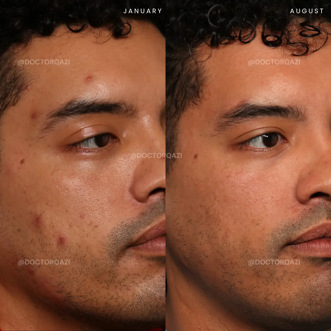 gallery.image.item,57