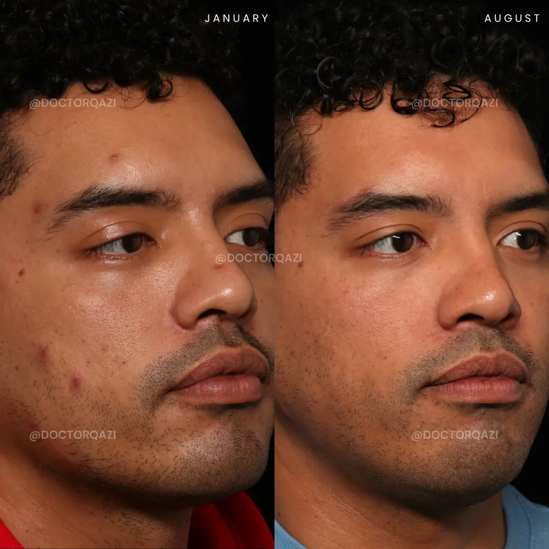 gallery.image.item,59