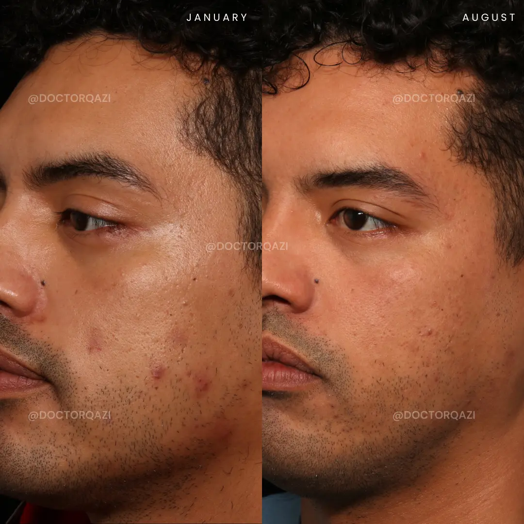 gallery.image.item,60