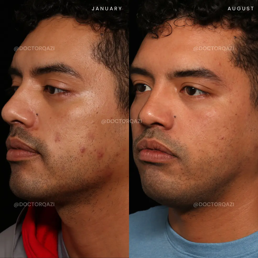 gallery.image.item,61