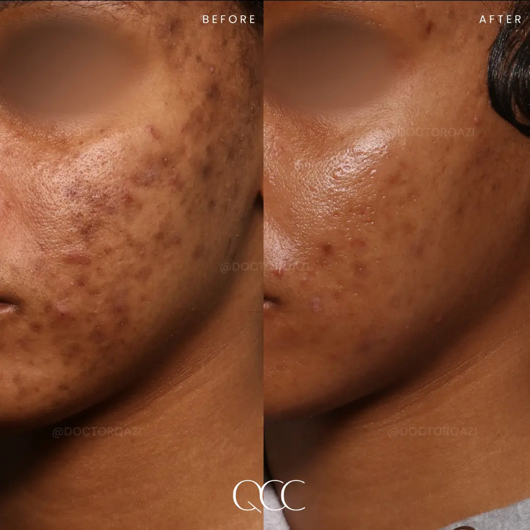 gallery.image.item,62