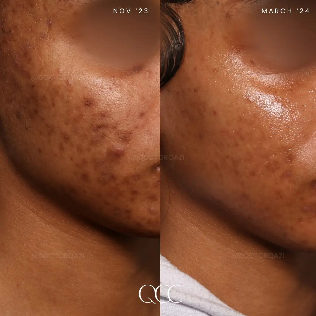 gallery.image.item,65