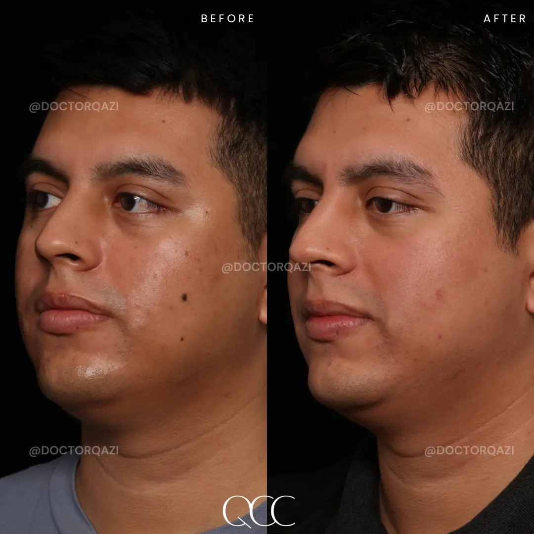 gallery.image.item,70