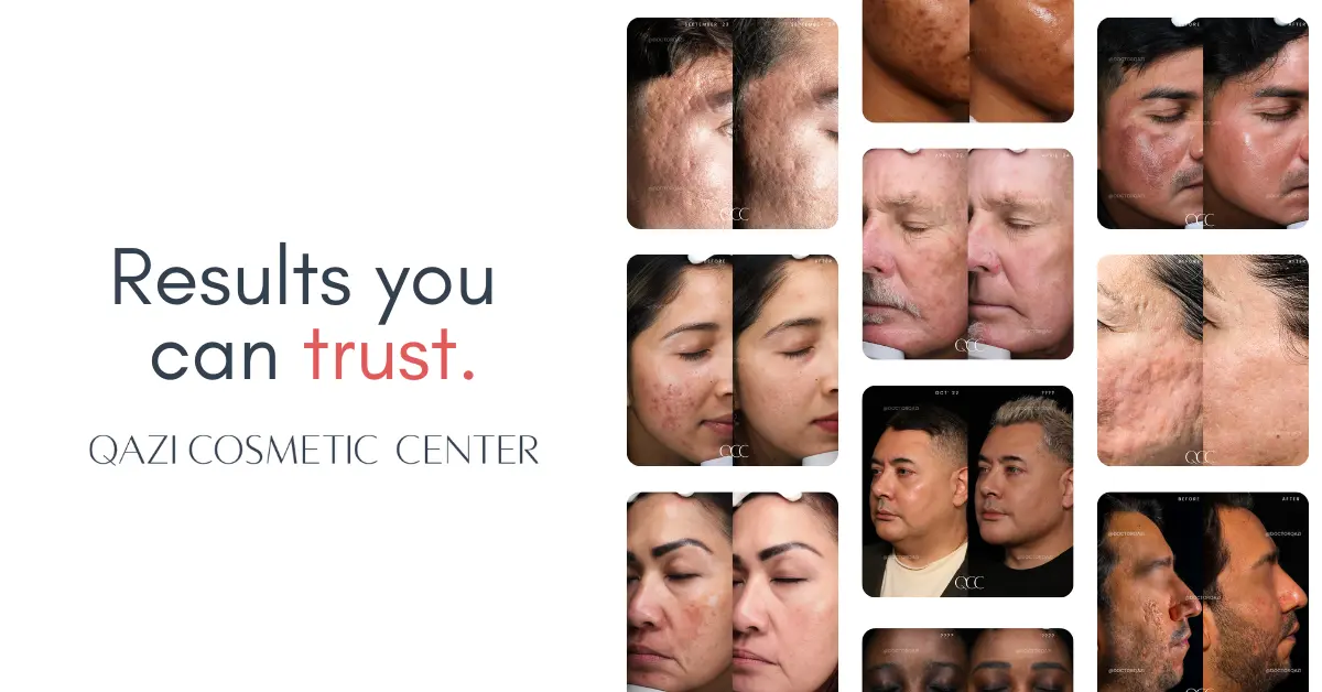 gallery.image.item,73