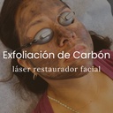 Academia Qazi - Exfoliación Facial Con Láser De Carbono