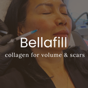 Bellafill Collagen Filler - Regular Pricing