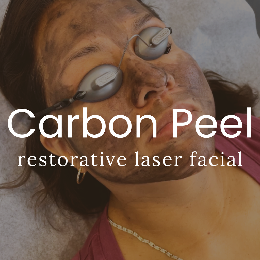 Carbon Laser Facial 50% OFF
