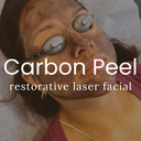 Carbon Peel Laser Facial (with PA/RN)