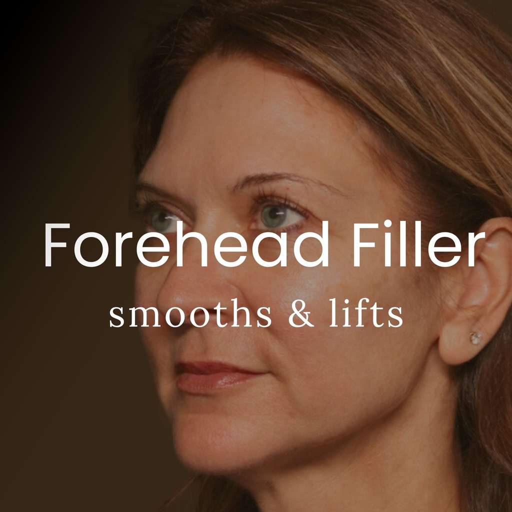 Forehead Filler - Crystal Pricing