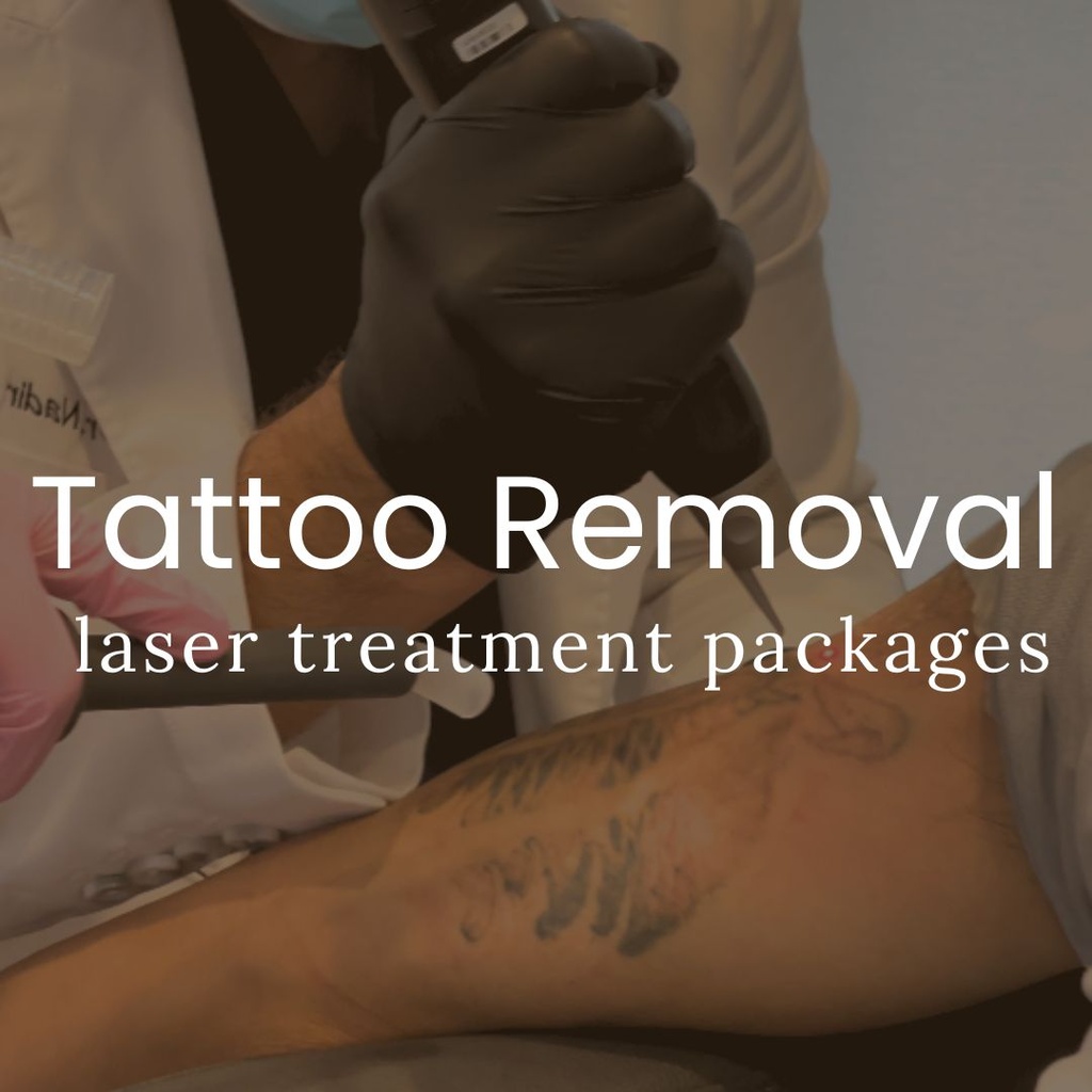 Laser Tattoo Removal - Packages of 8