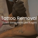 Laser Tattoo Removal - Packages of 8