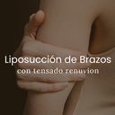 Liposucción de Brazos con Renuvion