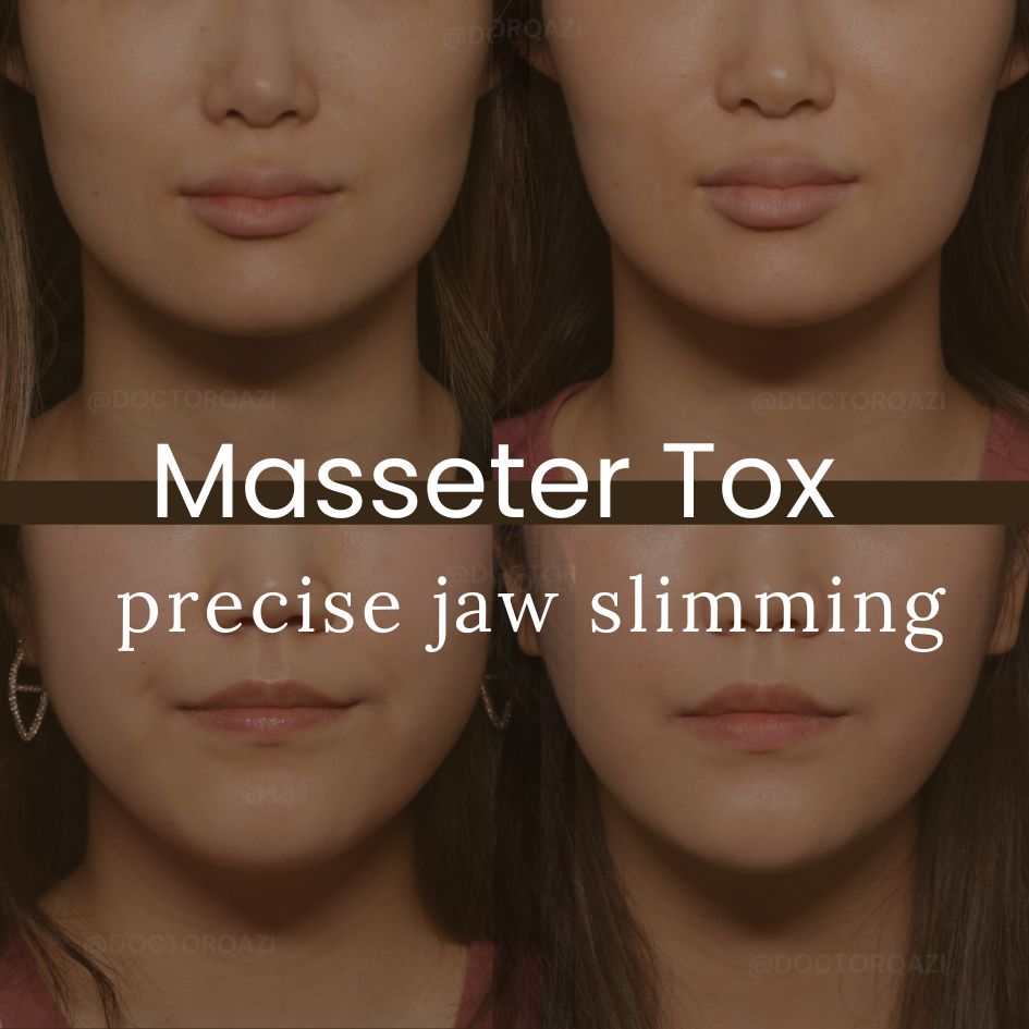 Masseter Tox - Sapphire Pricing