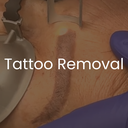 Mini Tattoo Removal