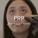 PRP for Undereyes - Crystal Pricing