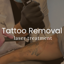 Qazi Academy - Laser Tattoo Removal - Small (Up to 3 Square Inches)