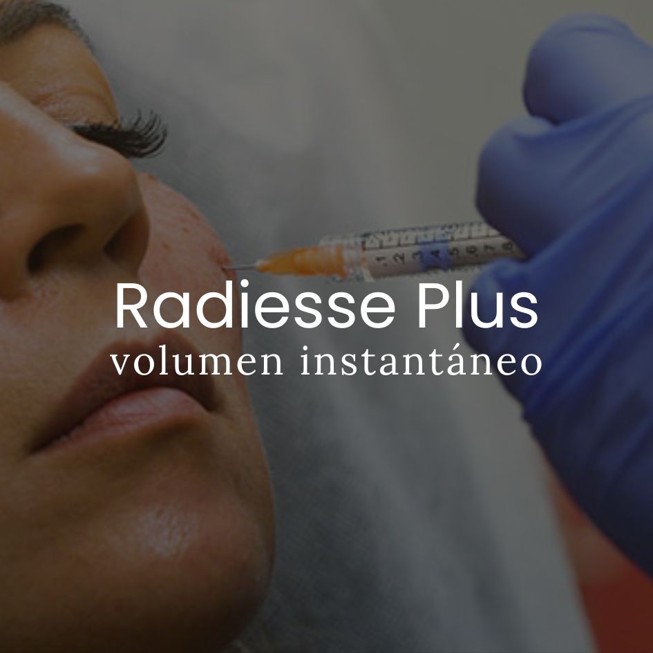 Radiesse Plus