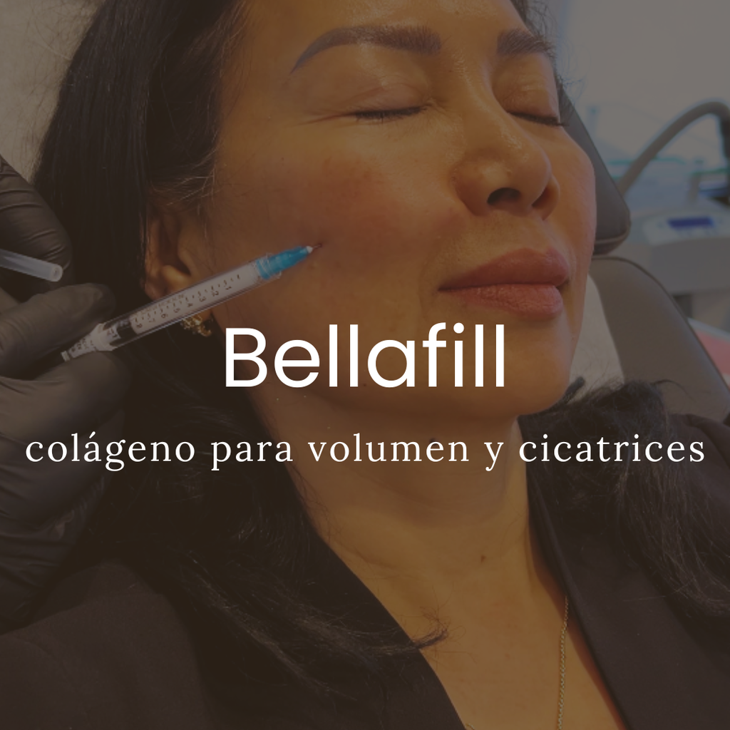 Relleno De Colágeno Bellafill