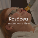 Tratamiento Láser Para Rosácea