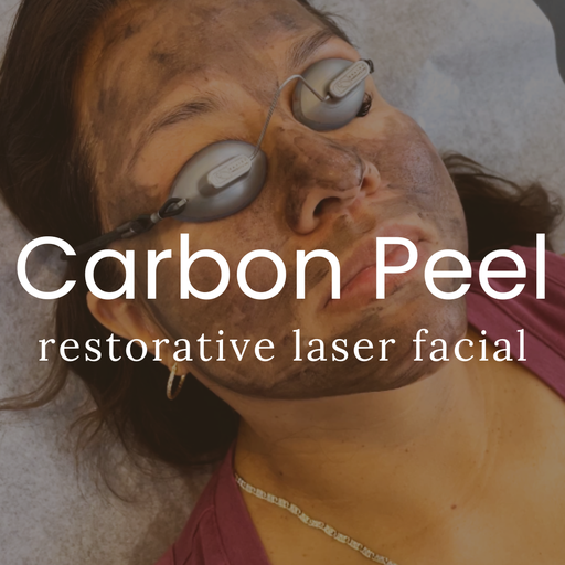 Carbon Peel Laser Facial (with PA/RN)