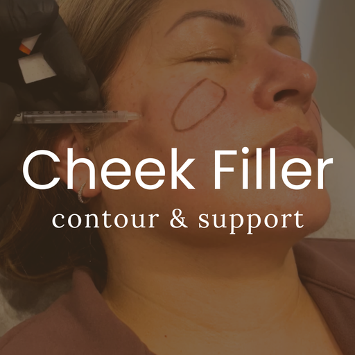 Cheek Filler - Regular Pricing