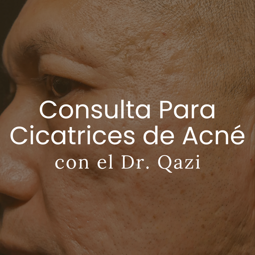 Consulta Para Cicatrices de Acné