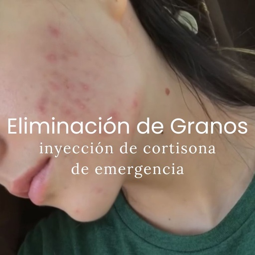 Eliminación de Granos de Emergencia