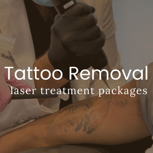 Laser Tattoo Removal - Packages of 8