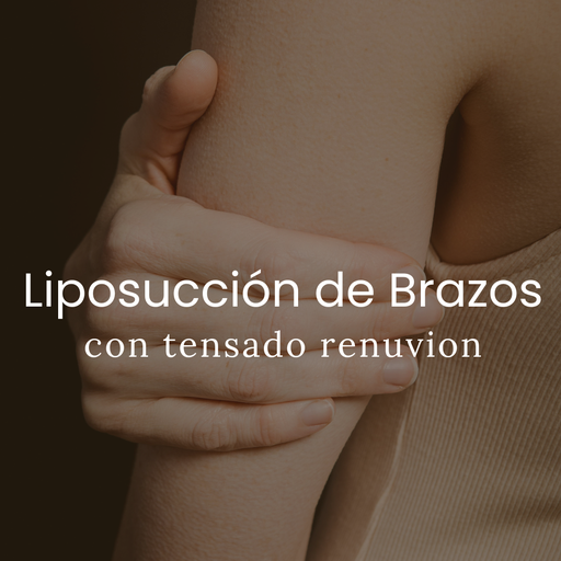 Liposucción de Brazos con Renuvion