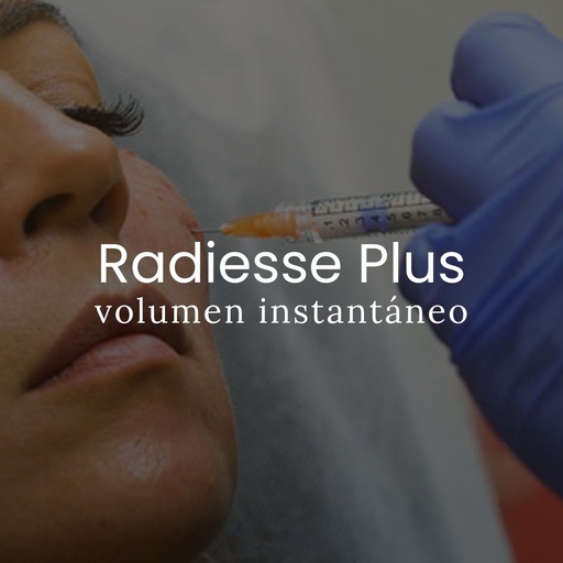 Radiesse Plus